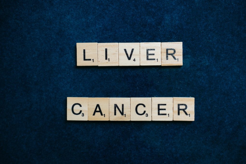 liver cancer